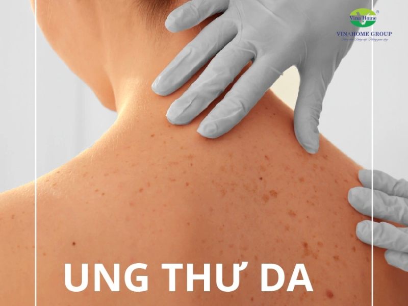 Tác hại của Tia UV